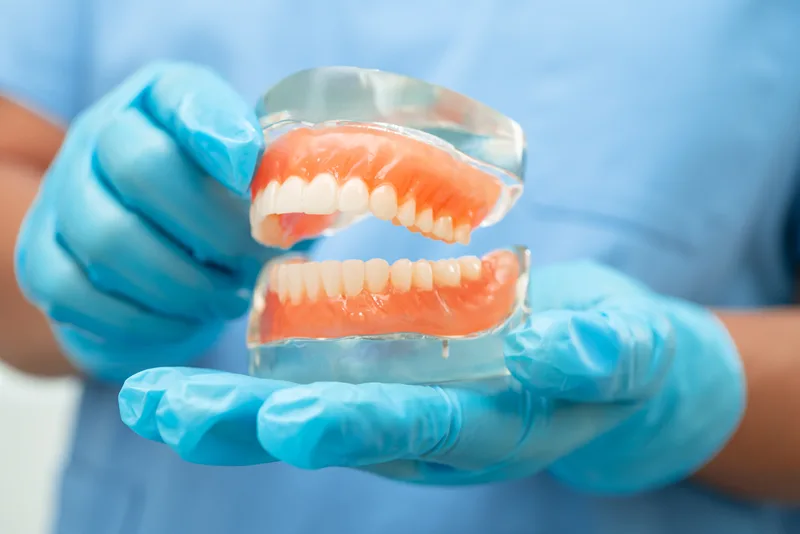Gloved hands holding dental model with teeth