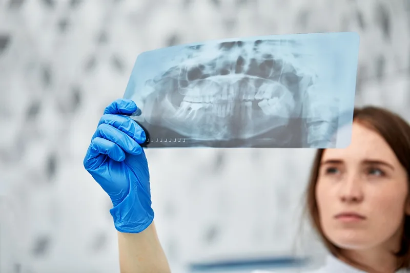 Female medical professional holding dental X-ray