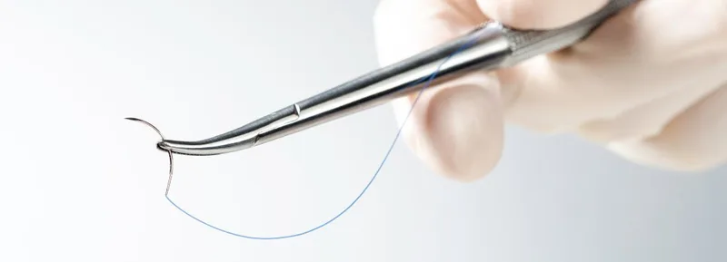 Gloved hand holding forceps with curved suture needle