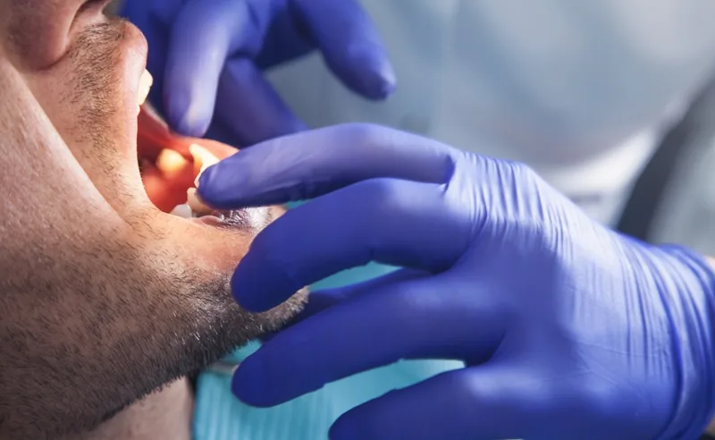 Dentist examining patient's open mouth